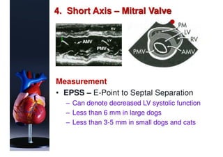 Basic Echocardiography | PDF