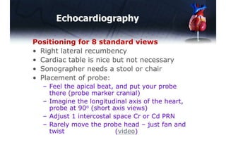 Basic Echocardiography | PDF
