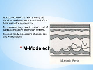 BASIC ECHOCARDIOGRAPHY.pptx............. | PPTX
