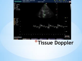 BASIC ECHOCARDIOGRAPHY.pptx............. | PPTX