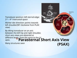 BASIC ECHOCARDIOGRAPHY.pptx............. | PPTX