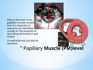 BASIC ECHOCARDIOGRAPHY.pptx............. | PPTX