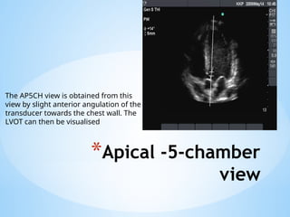 BASIC ECHOCARDIOGRAPHY.pptx............. | PPTX