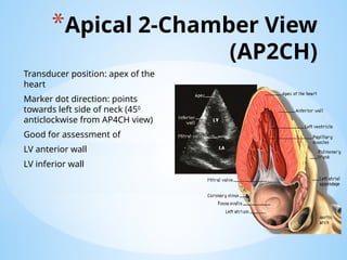 BASIC ECHOCARDIOGRAPHY.pptx............. | PPTX