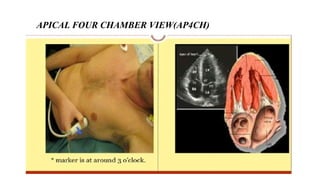 Comprehensive Guide to Basic Echocardiography and Cardiac Disease ...
