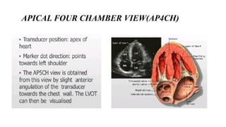 Comprehensive Guide to Basic Echocardiography and Cardiac Disease ...