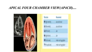 Comprehensive Guide to Basic Echocardiography and Cardiac Disease ...