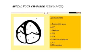Comprehensive Guide to Basic Echocardiography and Cardiac Disease ...