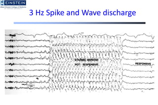 Basics Of EEG A Brief Review Of The EEG ppt basics-of-eeg-a-brief-review-of-the-eeg-ppt