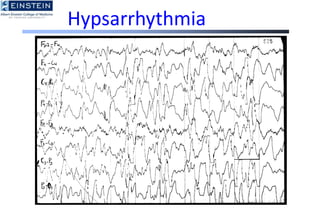 Basics of EEG - A brief review of the EEG.ppt