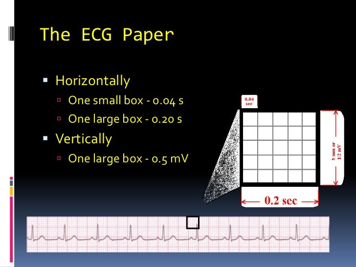 Basic ekg