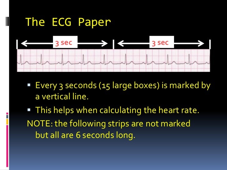 Basic ekg