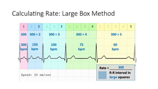 Understanding Ekg Box Basic EKG understanding of EKG for medical students | PPTX