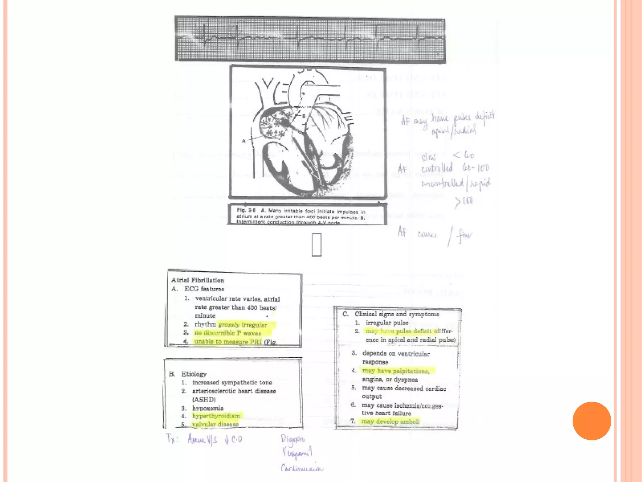 Basic EKG Notes