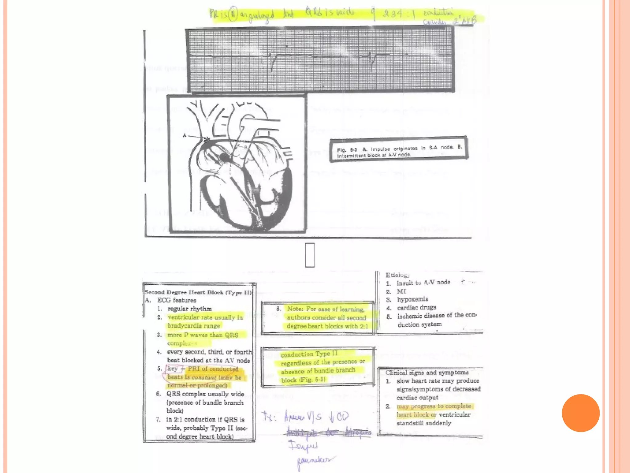 Basic EKG Notes