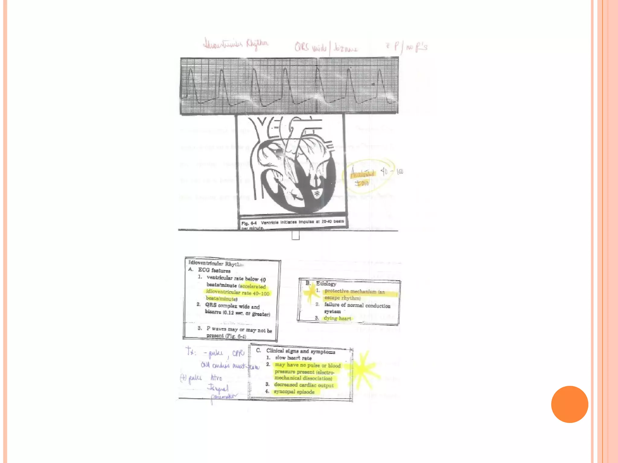Basic EKG Notes