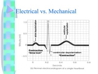 Electrical vs. Mechanical “ Contraction” Contraction “ Atrial kick” 
