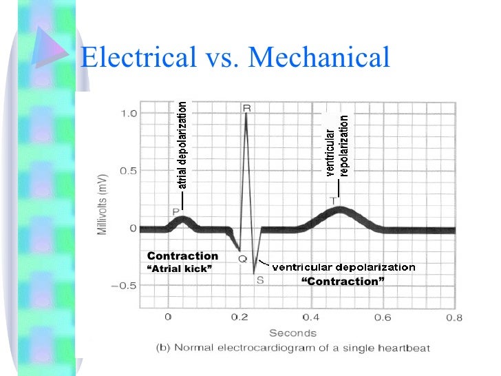 Basic Ekg Reviewr2