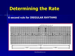 Basic EKG | PPT