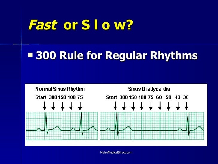 Basic Ekg