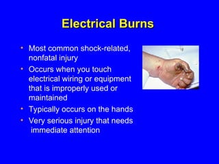 Basic Electrical Presentation.ppt in term engr | PPT