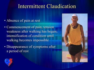 Intermittent Claudication
• Absence of pain at rest
• Commencement of pain, tension
weakness after walking has begun;
intensification of condition until
walking becomes impossible
• Disappearance of symptoms after
a period of rest
 