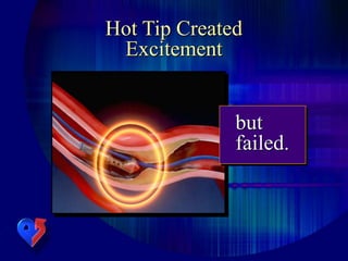 Hot Tip Created
Excitement
but
failed.
 