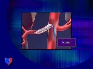 Renal
 