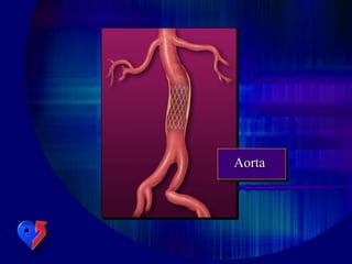 Aorta
 