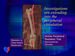 Investigations
are extending
into the
peripheral
circulation
Mobile Peripheral
Radiation Trial
Sponsored by:
Novoste
Radiation to
Treat Instent
Restenosis
 