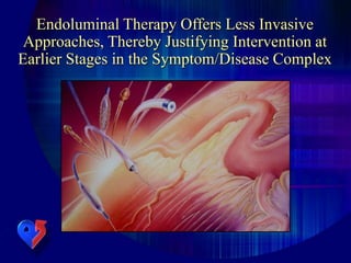 Endoluminal Therapy Offers Less Invasive
Approaches, Thereby Justifying Intervention at
Earlier Stages in the Symptom/Disease Complex
 