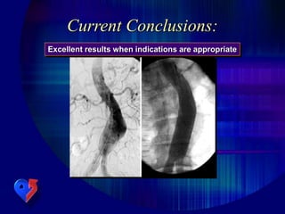 Current Conclusions:
Excellent results when indications are appropriate
 