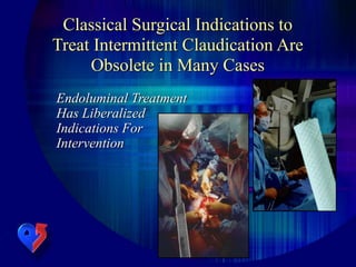 Classical Surgical Indications to
Treat Intermittent Claudication Are
Obsolete in Many Cases
Endoluminal Treatment
Has Liberalized
Indications For
Intervention
 