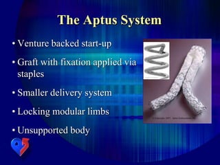 The Aptus System
• Venture backed start-up
• Graft with fixation applied via
staples
• Smaller delivery system
• Locking modular limbs
• Unsupported body
 
