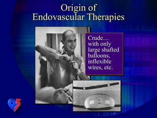 Origin of
Endovascular Therapies
Crude…
with only
large shafted
balloons,
inflexible
wires, etc.
 