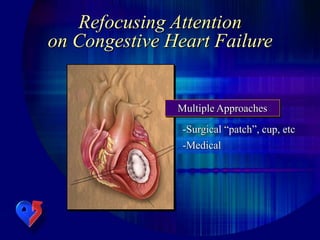 -Medical
-Surgical “patch”, cup, etc
Multiple Approaches
Refocusing Attention
on Congestive Heart Failure
 