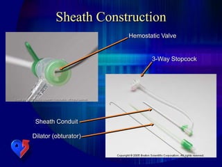Sheath Construction
Hemostatic Valve
3-Way Stopcock
Sheath Conduit
Dilator (obturator)
 