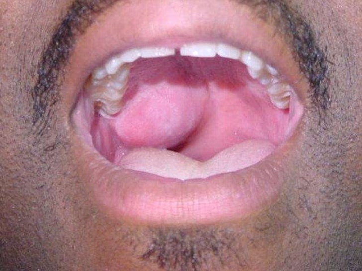 Basic ENTHNS physical examination