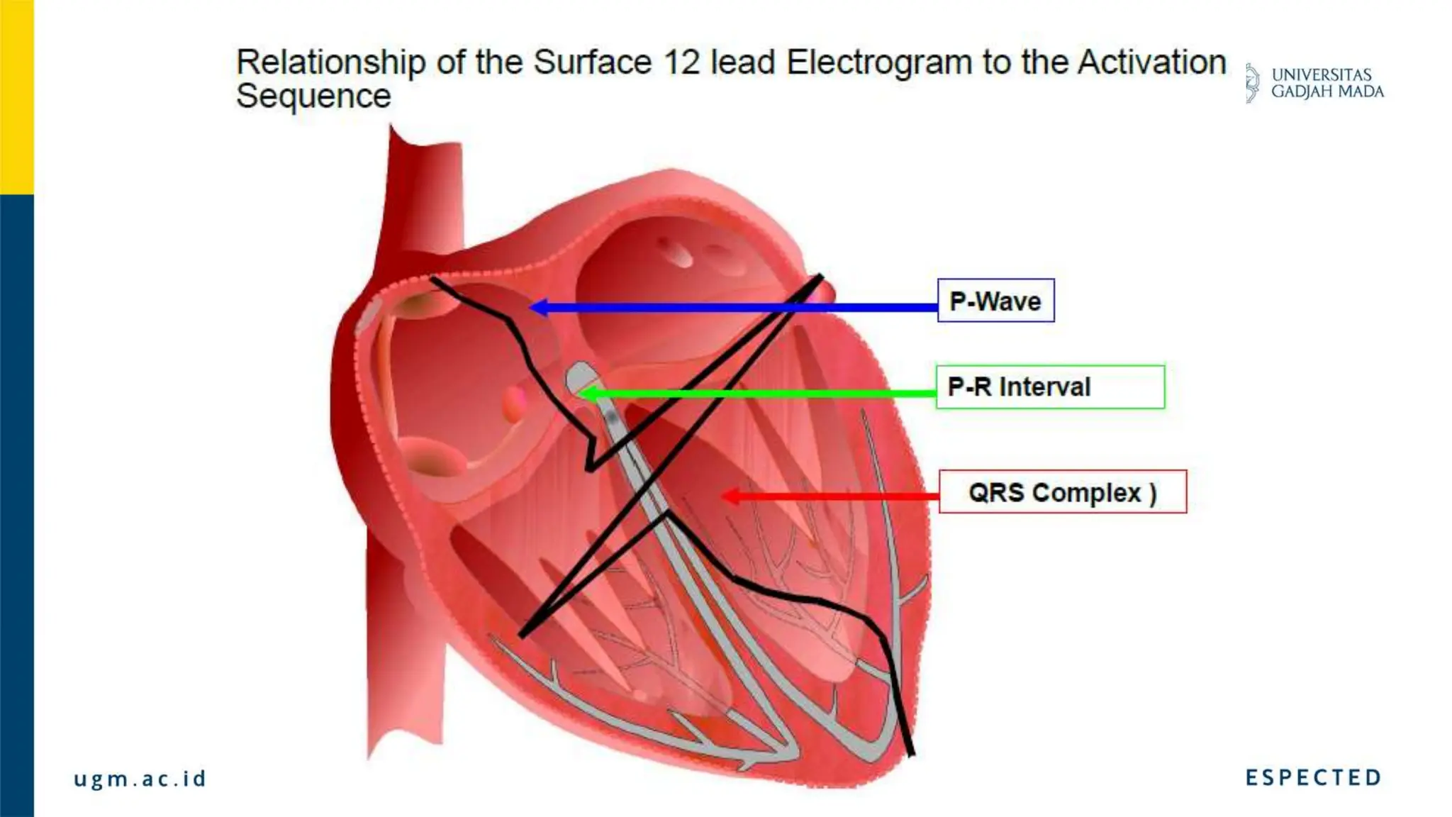 Basic Electrophysiology study and EGM material.pptx