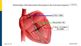 Basic Electrophysiology study and EGM material.pptx