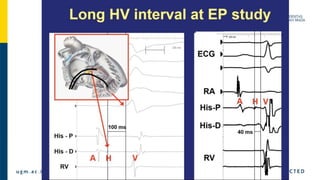 Basic Electrophysiology study and EGM material.pptx