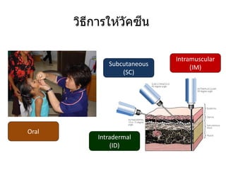 Intramuscular
(IM)
Subcutaneous
(SC)
Intradermal
(ID)
Oral
วิธีการให ้วัคซีน
 