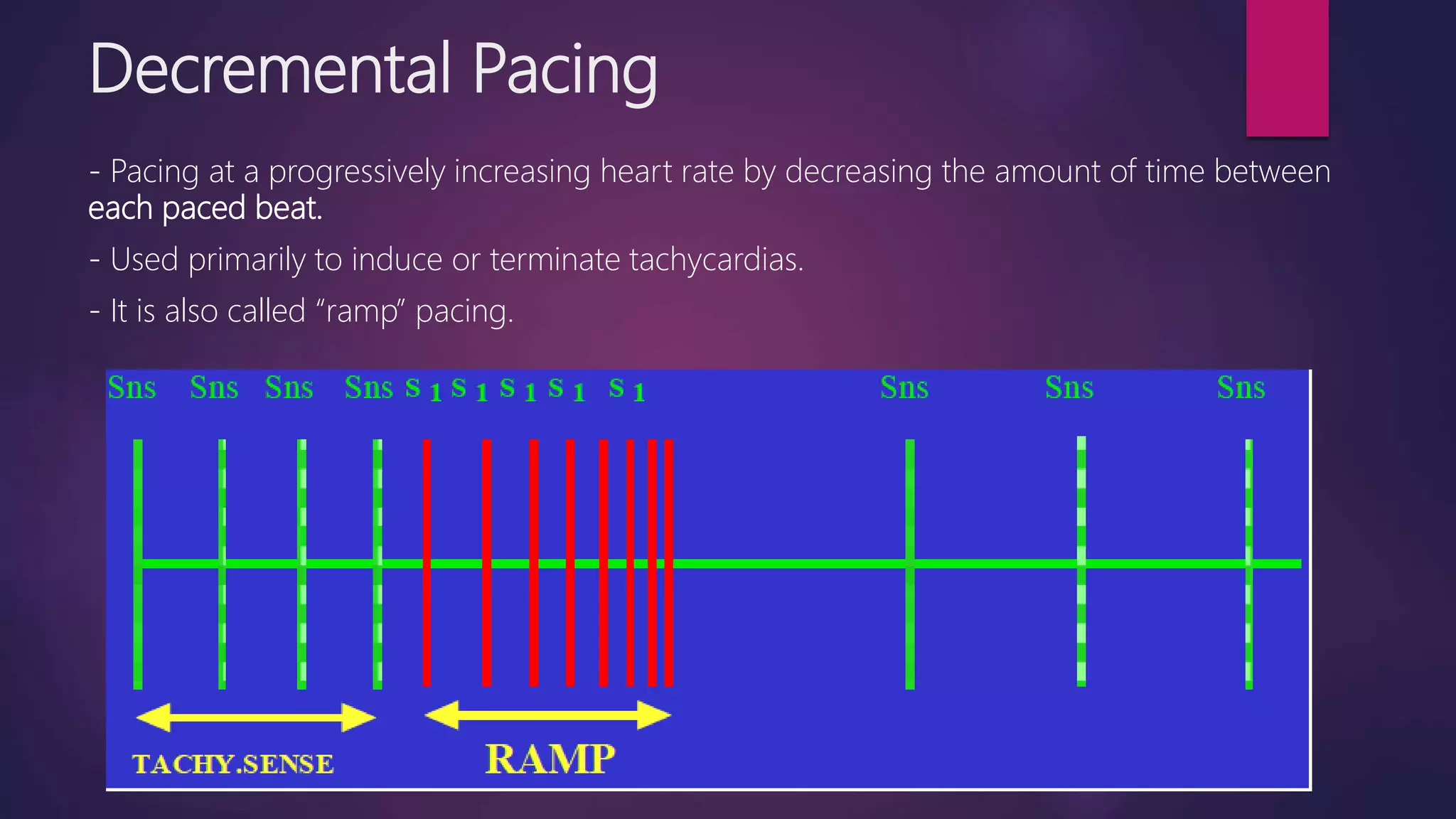 Decremental Pacing
- Pacing at a progressively increasing heart rate by decreasing the amount of time between
each paced beat.
- Used primarily to induce or terminate tachycardias.
- It is also called “ramp” pacing.
 