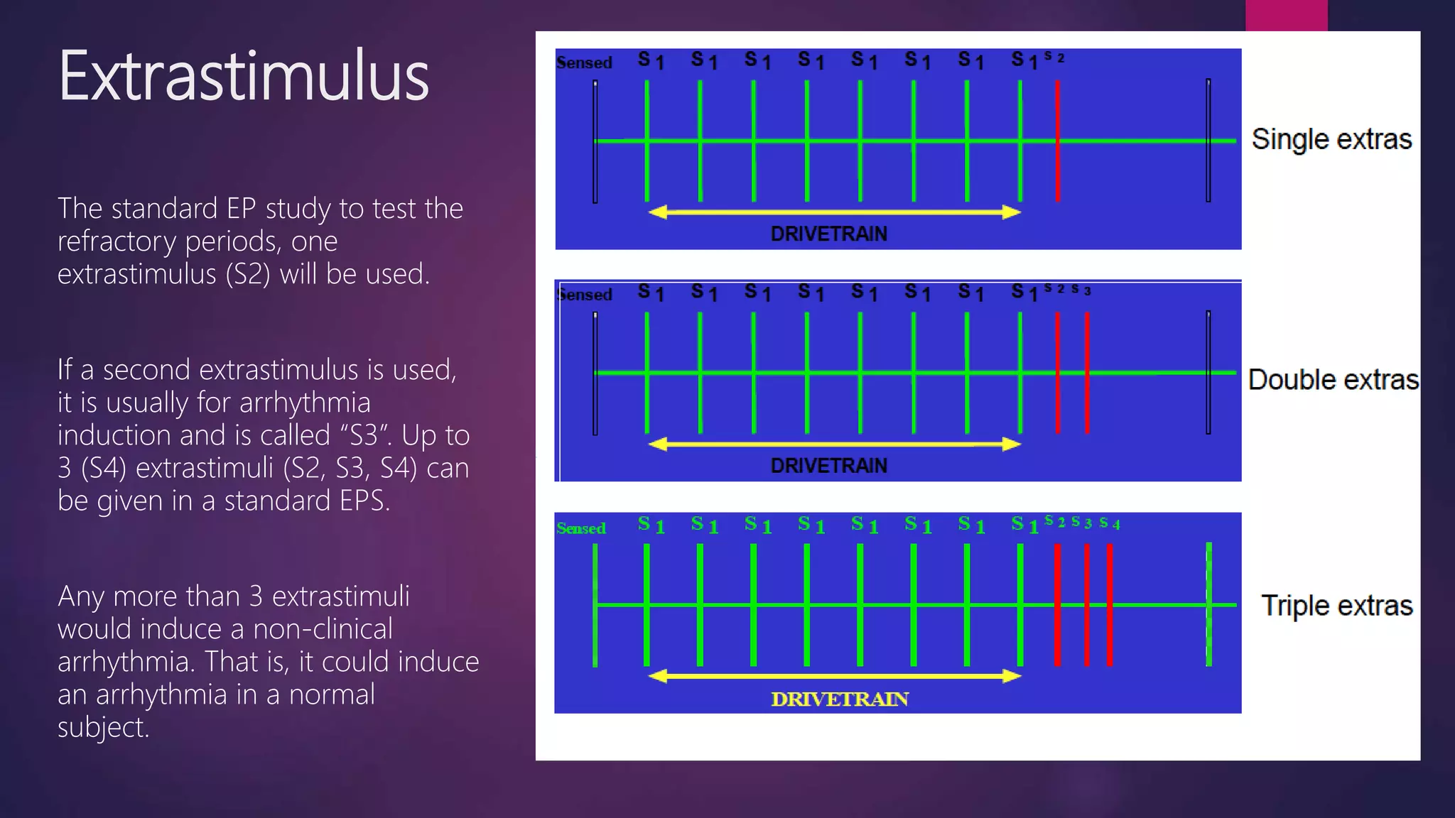 Extrastimulus
The standard EP study to test the
refractory periods, one
extrastimulus (S2) will be used.
If a second extrastimulus is used,
it is usually for arrhythmia
induction and is called “S3”. Up to
3 (S4) extrastimuli (S2, S3, S4) can
be given in a standard EPS.
Any more than 3 extrastimuli
would induce a non-clinical
arrhythmia. That is, it could induce
an arrhythmia in a normal
subject.
 