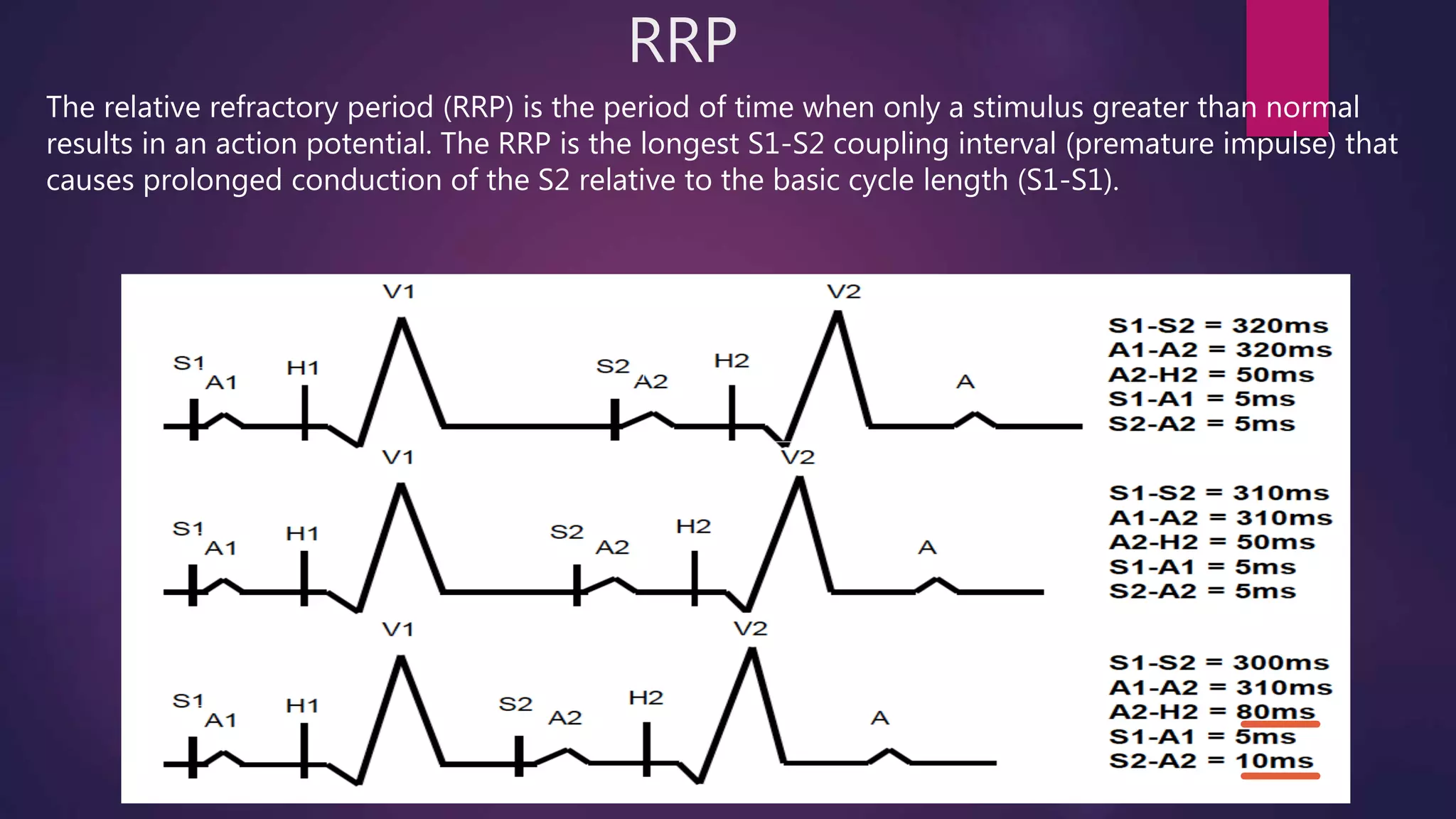 RRP
The relative refractory period (RRP) is the period of time when only a stimulus greater than normal
results in an action potential. The RRP is the longest S1-S2 coupling interval (premature impulse) that
causes prolonged conduction of the S2 relative to the basic cycle length (S1-S1).
 