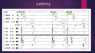 Basic EP study (part1) | PPTX