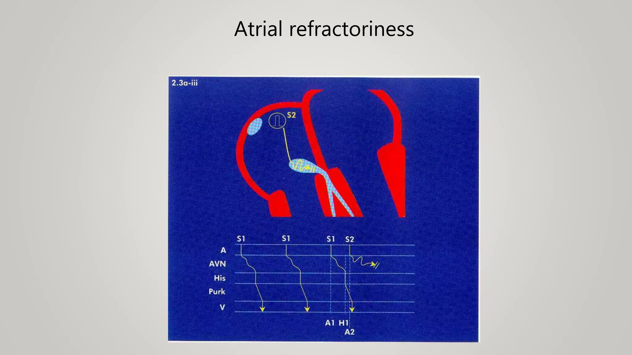 Atrial refractoriness
 