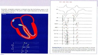Basic EP study part 2 | PPTX