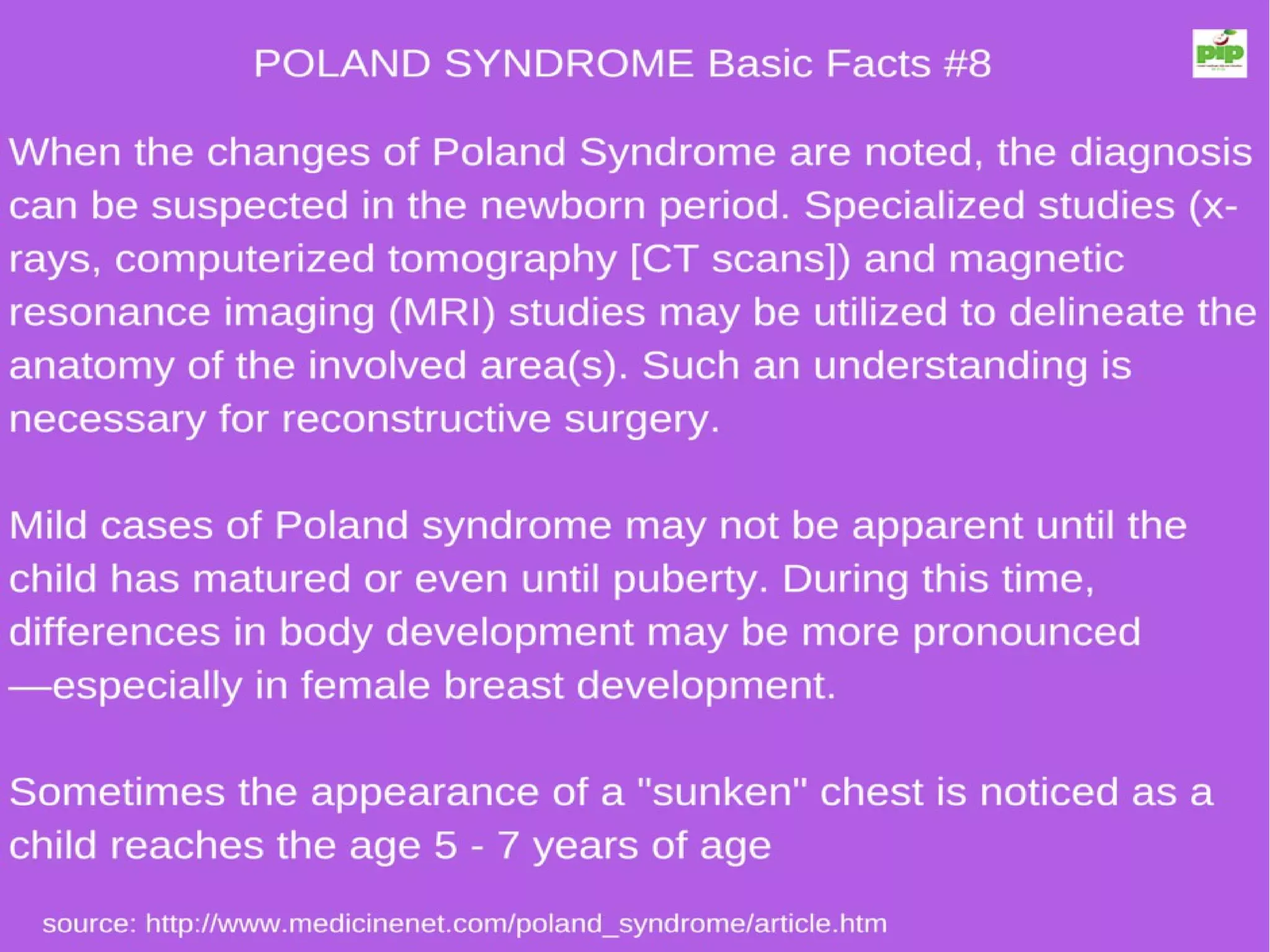 Poland Syndrome 10 Basic Facts | PDF | Blood Disorders | Diseases and ...