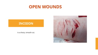 Basic First-Aid Lecture and otherssssssss | PPTX